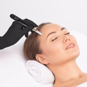microneedling